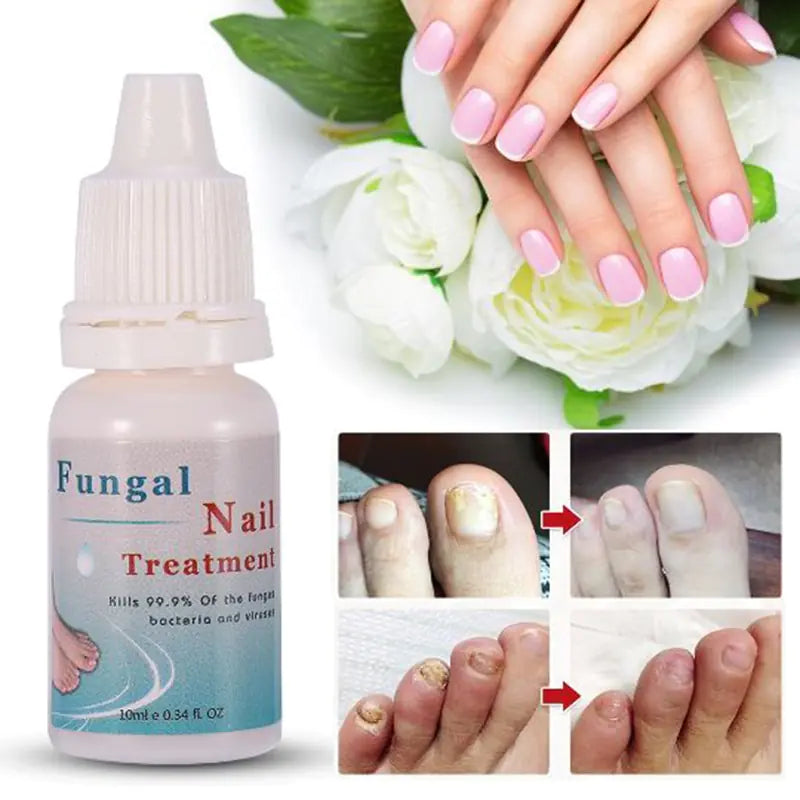 10ml Nail Repair Liquid for Fungal Treatment and Care